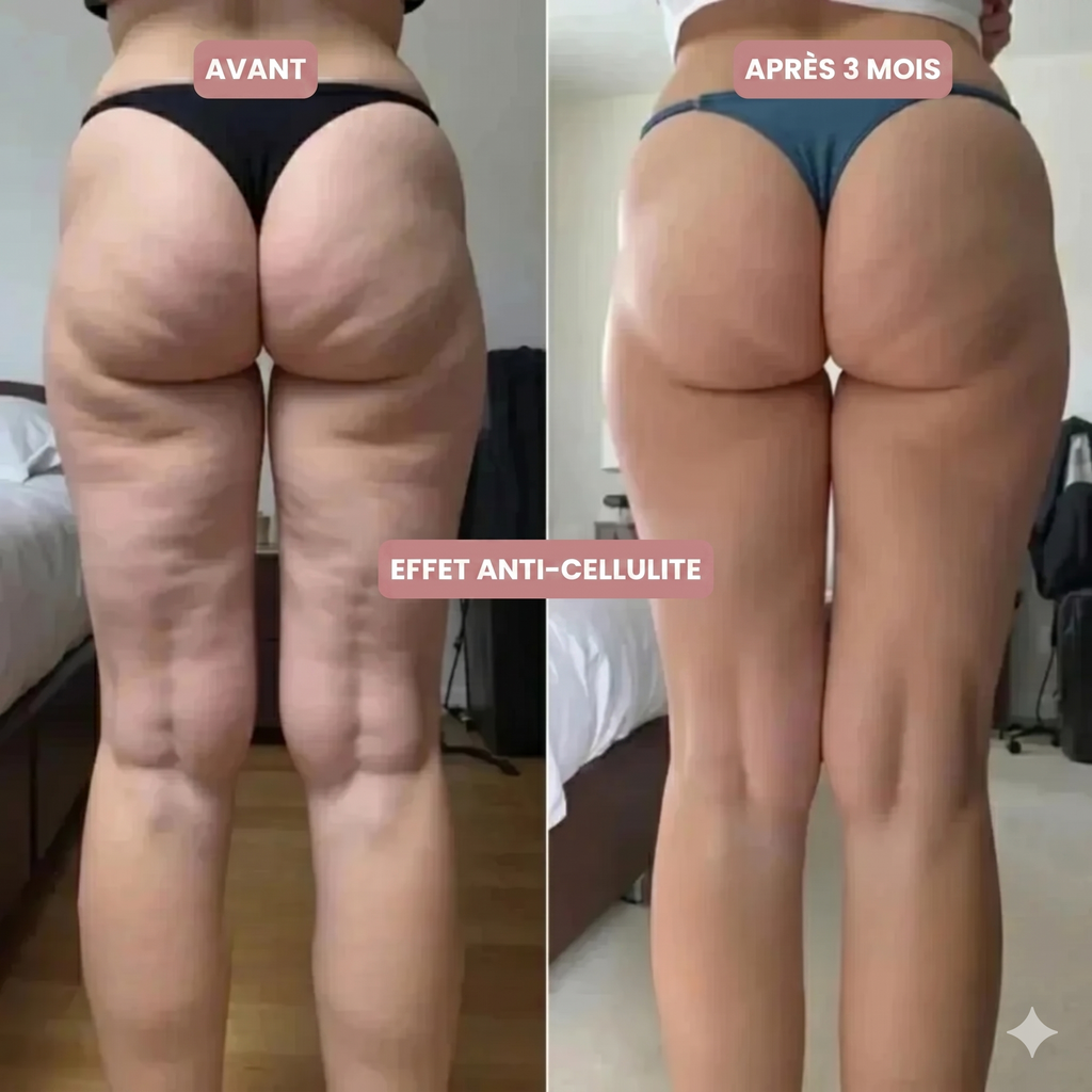 Legging Drainant & Anti-Cellulite 3D