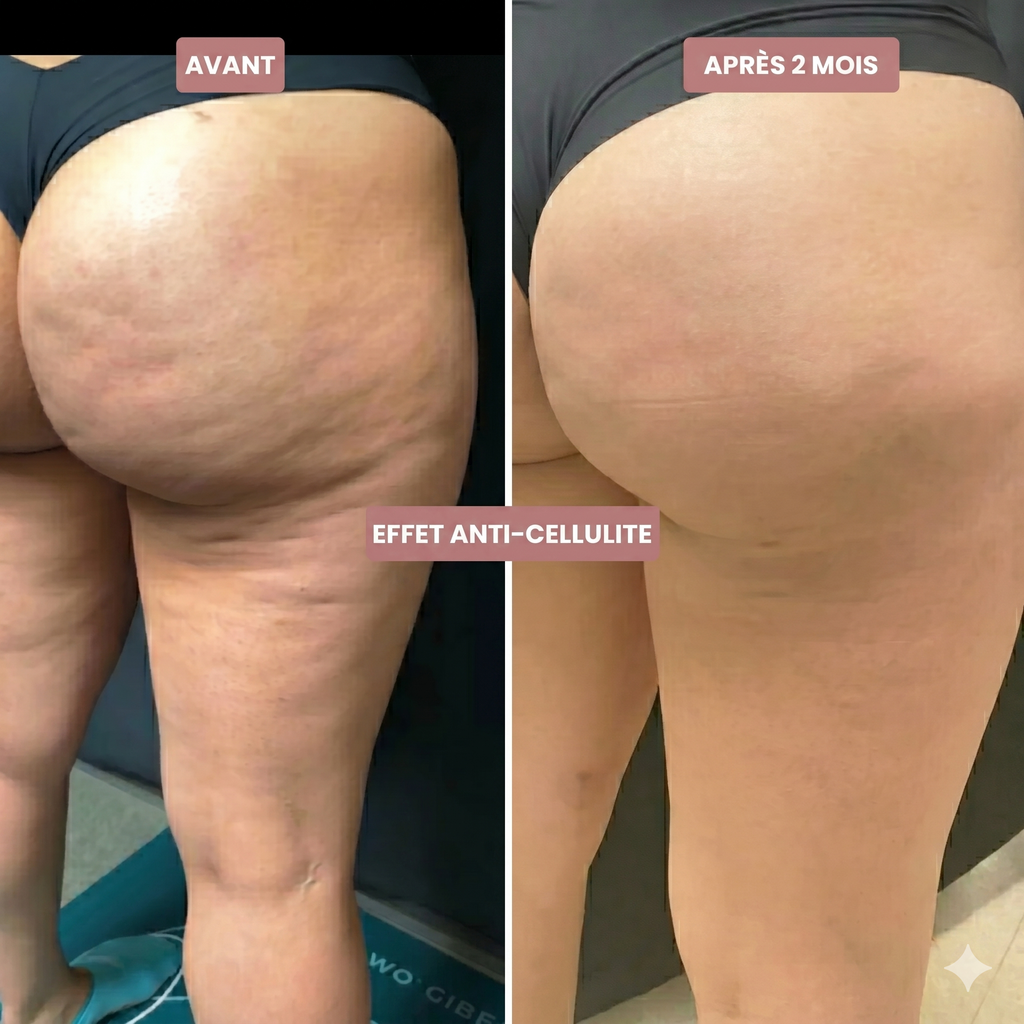 Legging Drainant & Anti-Cellulite 3D