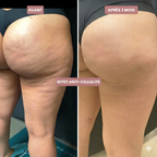 Legging Drainant & Anti-Cellulite 3D